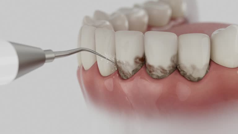 Reliable Dental contractor in Marshall, AR by Smile Center Dentistry